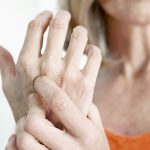 arthritis treatment plan